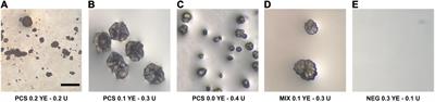 Biomineralization in Cave Bacteria—Popcorn and Soda Straw Crystal Formations, Morphologies, and Potential Metabolic Pathways